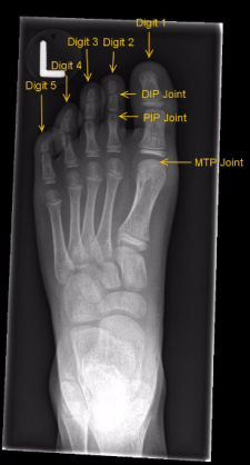 Musculoskeletal Undergraduate Diagnostic Imaging Fundamentals