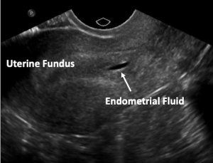 ULTRASOUND (US) OVERVIEW, METHODS, TIPS & IMAGES – TEACH Abortion ...