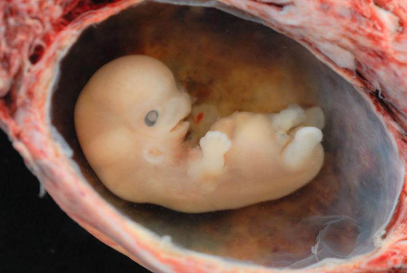 Image of an embryo