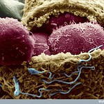 Scanning electron micrograph of a human embryo at day 4. The protein coat surrounding the egg (zona pellucida, gold) has been slit to expose the embryonic cells inside (red). These cells go on to form the embryo and can be harvested and cultured to give rise to embryonic stem (ES) cells. Microvilli are visible on the surface of the embryonic cells (blastomeres) and numerous sperm (blue) are still visible on the outside of the zona pellucida.