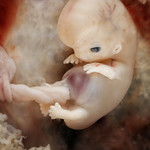 Image of an embryo at 7-8 weeks since conception.