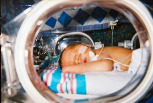 Image of a newborn in a neonatal unit.