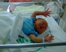 Image of infant spreading their arms out to demonstrate a moro reaction. 