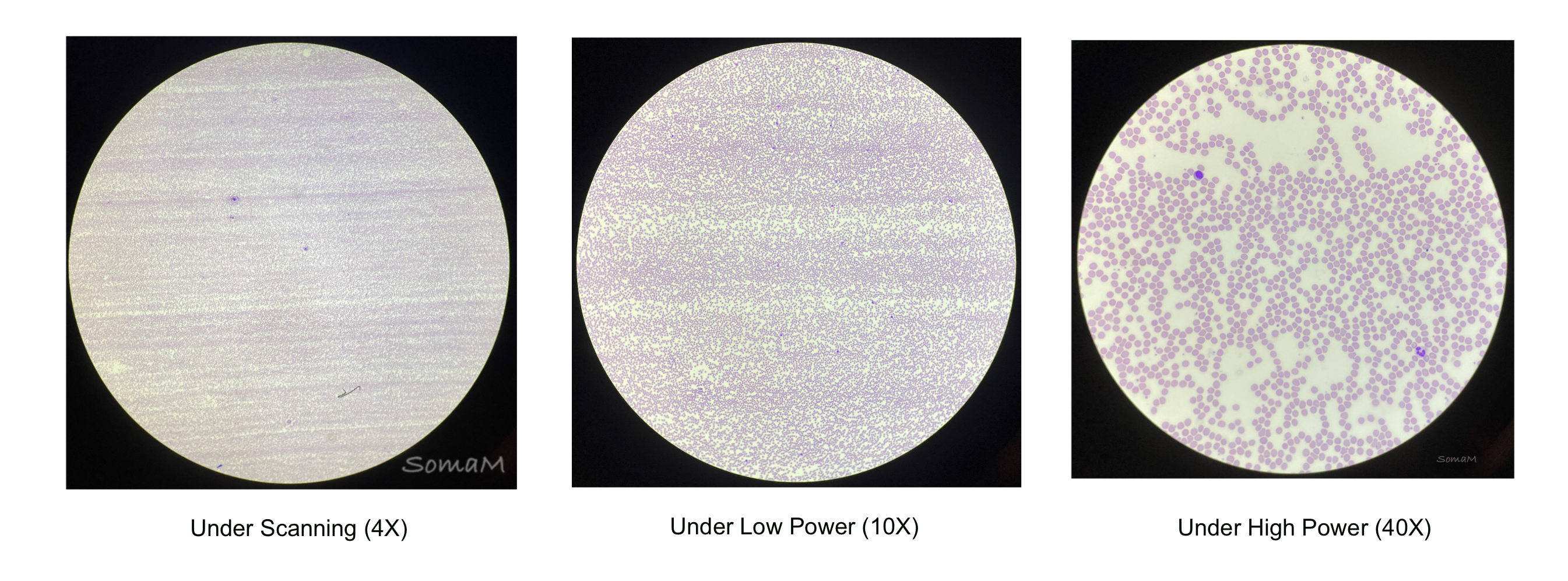 Blood smear at 4x, 10x, and 40x magnification.