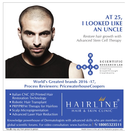 The ad states "At 25, I looked like an uncle" and features a balding man advertising for hair replacement