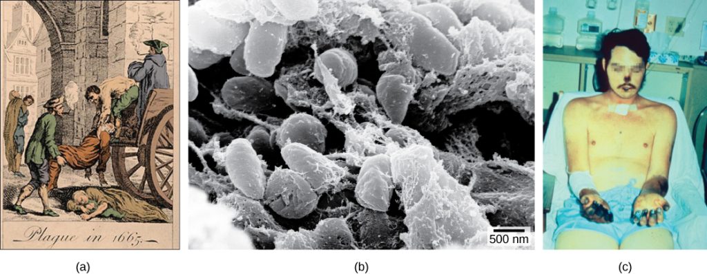 Illustration A shows two men loading a dead body onto a cart. Another body lies in the street. Label beneath the illustration says, Plague in 1665. Micrograph B shows rod shaped bacteria. Photo C shows a man with black gangrene on his fingers, arm, nose and lips.