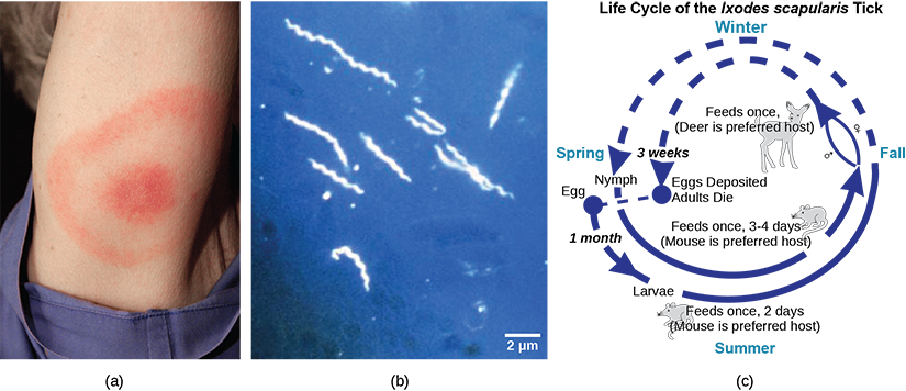 Part A shows the red, bullseye-shaped rash of a person infected with Borrelia. Part B shows a micrograph of Borrelia, which look like tiny corkscrews. Part C shows the life cycle of the bacteria, which begins when Borrelia infect a tick egg. The egg hatches into larva, which feeds on a mouse, then into a nymph, which also feeds on a mouse. The nymph feeds again, this time on a deer, or sometimes a human.