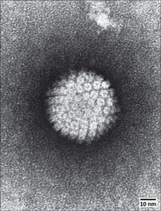 The micrograph shows an icosahedral virus with glycoproteins protruding from its capsid.