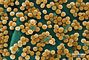 The micrograph shows clusters of round bacteria clinging to a surface. Each bacterium is about 0.4 microns across.