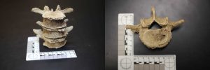 Different views of vertebrae