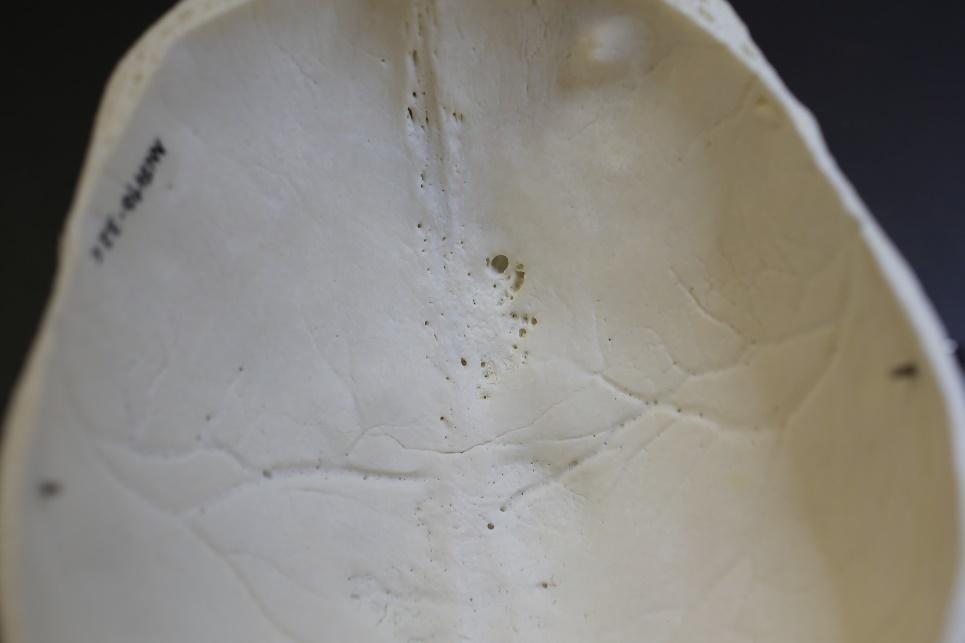The inside of a skull, showing small holes.