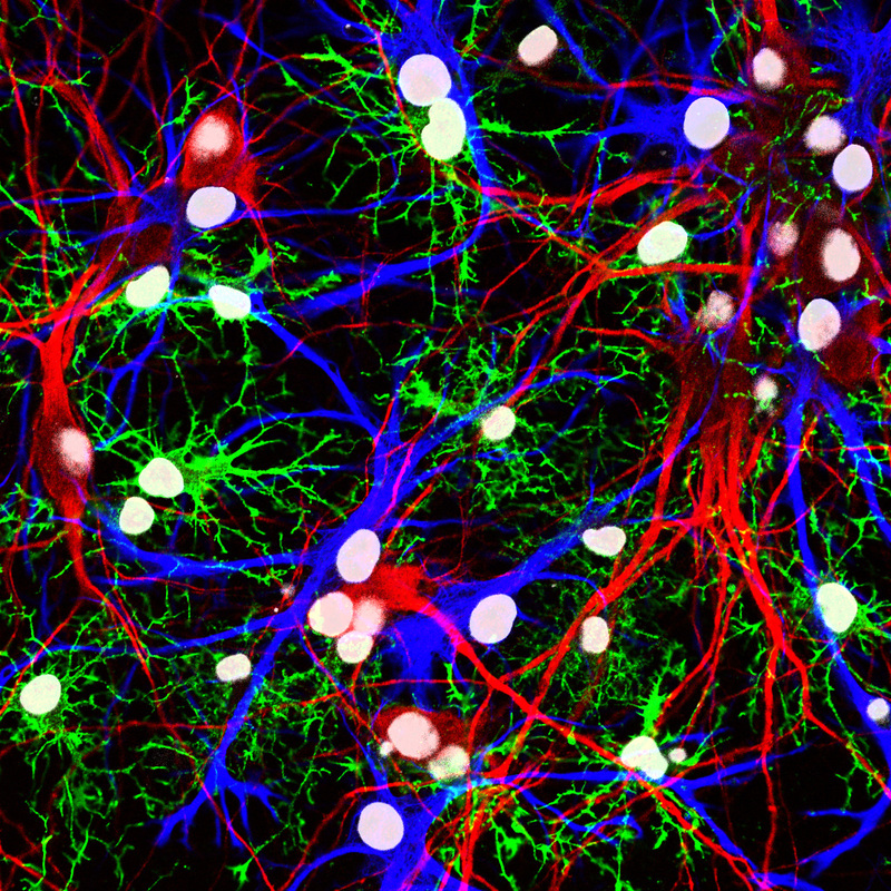 CGI of neurons firing