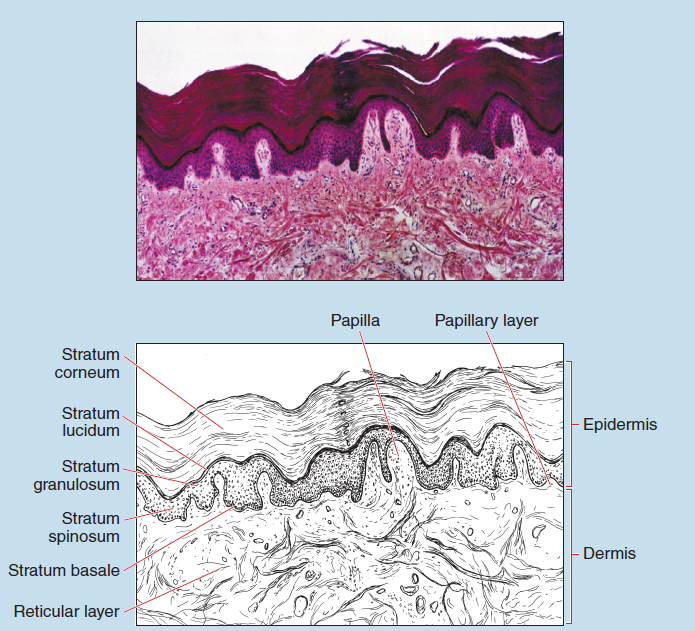 Figure 17-1 is a slide image (upper) and sketch image (lower) of thick skin (Caucasian) at 25X magnification. The sketch is labelled to illustrate papilla, papillary layer, epidermis, dermis, stratum corneum, stratum lucidum, stratum granulosum, stratum spinosum, stratum basale, and a reticular layer.