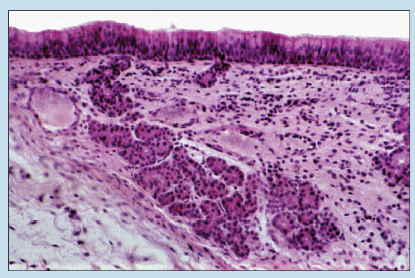 Figure 10-2 is a slide image of trachea at 50X magnification.
