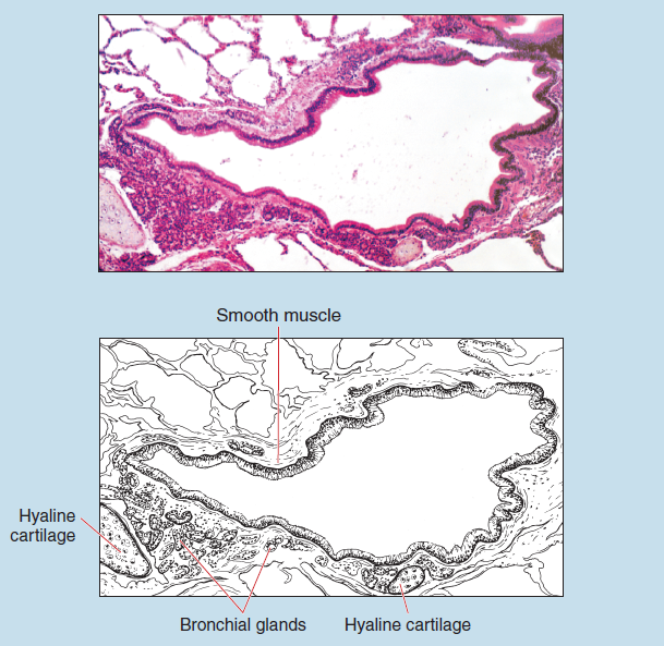 Figure 10-3 is a slide image (upper) and a sketch image (lower) of bronchus at 25X magnification. The sketch is labelled to show smooth muscle, hyaline cartilage, bronchial glands/