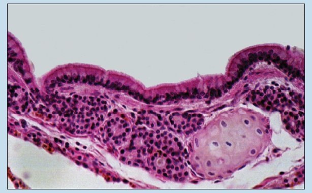 Figure 10-4 is a slide image of bronchus at 50X magnification.