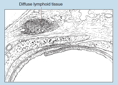 Figure 11-1 is a slide image (upper) and a sketch image (lower) of diffuse lymphoid tissue associated within a bronchus of the respiratory system at 25X magnification. The sketch is labelled to show diffuse lymphoid tissue.