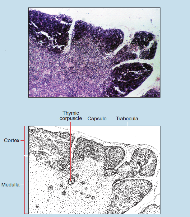 Figure 11-10 slide image (upper) and a sketch image (lower) of thymus of a child at 25X magnification. It is labelled to show medullay, cortex, thymic corpuscle, capsule, and trabecula.