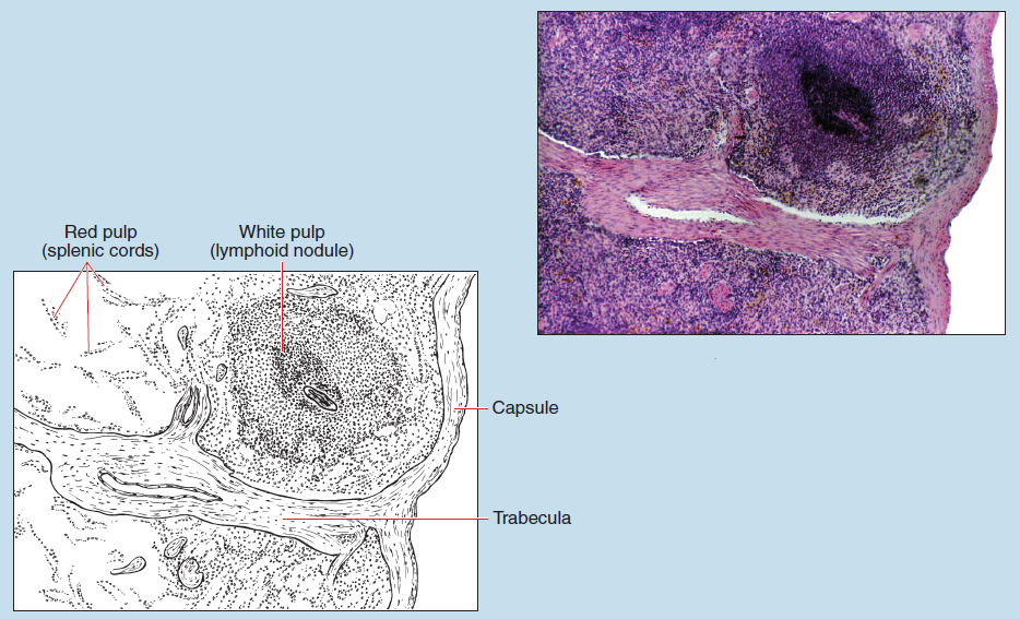 Figure 11-15 slide image (upper) and a sketch image (lower) of spleen at 25X magnification. The sketch is labelled to show red pulp (splenic cords), white pulp (lymphoid nodules), capsule, trabecula.