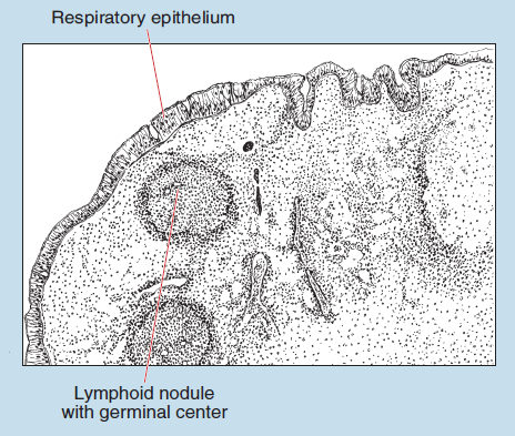 Figure 11-4 slide image (upper) and a sketch image (lower) of pharyngeal tonsil at 25X magnification. The sketch is labelled to show respiratory epithelium and lymphoid nodule with germinal center.