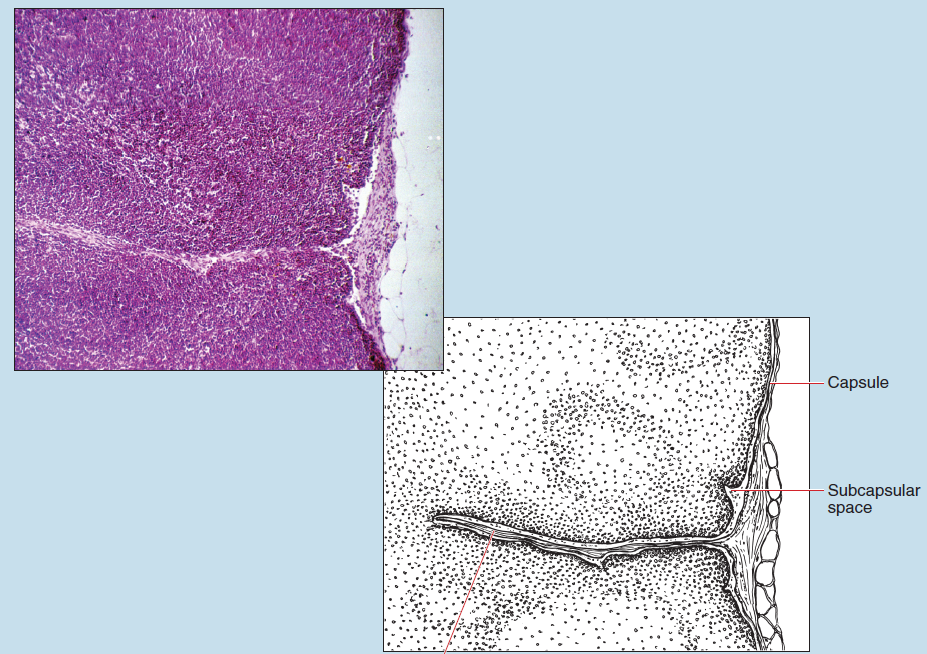 Figure 11-6 slide image (upper) and a sketch image (lower) of lymph node at 25X magnification. The sketch is labelled to show capsule, subcapsular space, and trabecula.