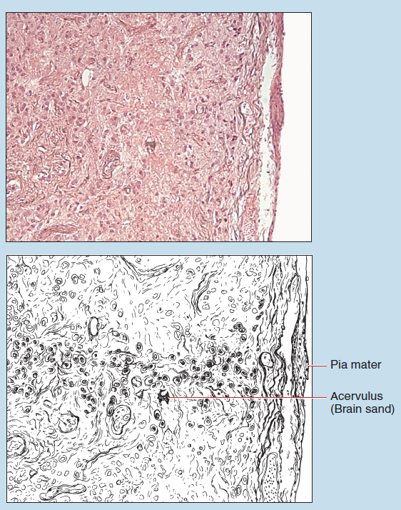Figure 13-14 is a slide image (upper) and a sketch image (lower) of pineal gland at 35X magnification. The sketch is labelled to show pia mater and acervulus (brain sand).