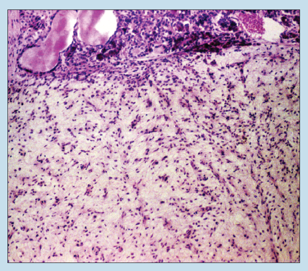 Figure 13-3 is a slide image of neural lobe (pars nervosa) of the neurophypophysis (posterior lobe) of the pituitary at 25X magnification.