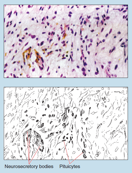 Figure 13-4 is a slide image (upper) and a sketch image (lower) of neural lobe (pars nervosa) of the neurohypophysis (posterior lobe) of the pituitary at 100X magnification. The sketch is labelled to show neursecretory bodies and pituicytes.