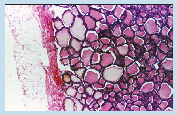 Figure 13-5 is a slide image of thyroid gland at 25x magnification.