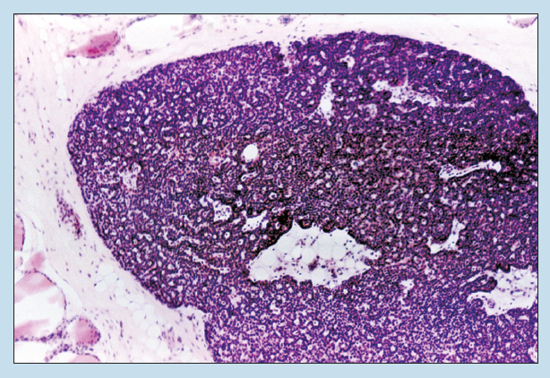 Figure 13-7 is a slide image of parathyroid gland at 25X magnification.