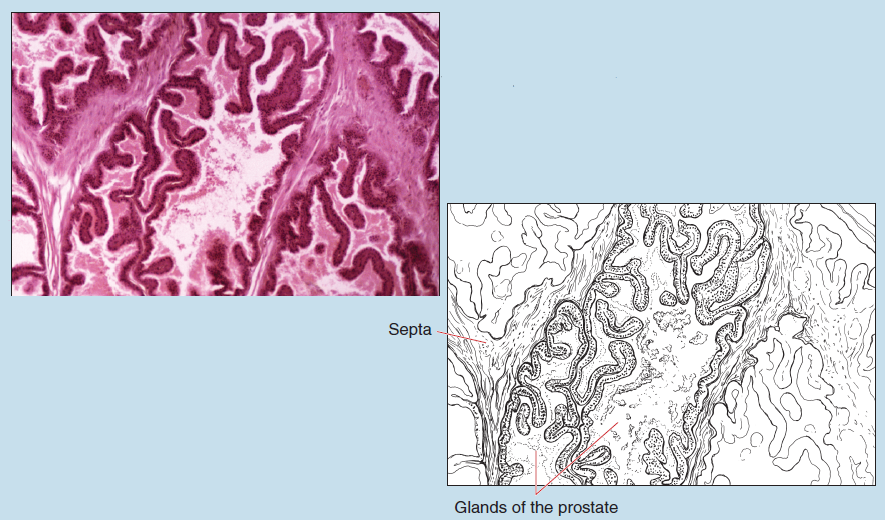 Figure 14-9 is a slide image (upper) and a sketch image (lower) of prostate at 25X magnification. The sketch is labelled to show septa and glands of the prostate.
