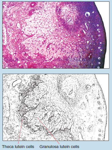 Figure 15-7 is a slide image (upper) and a sketch image (lower) of corpus luteum within the ovary at 50X magnification. The sketch is labelled to show theca lutein cells and granulosa lutein cells.