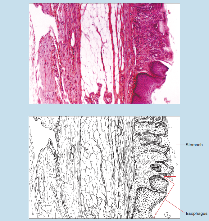 Figure 16-12 is a slide image (upper) and sketch image (lower) of cardioesophageal junction at 25X magnification. The sketch is labelled to demonstrate stomach and esophagus.