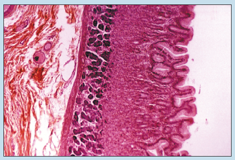 Figure 16-15 is a slide image of fundic stomach at 50X magnification.