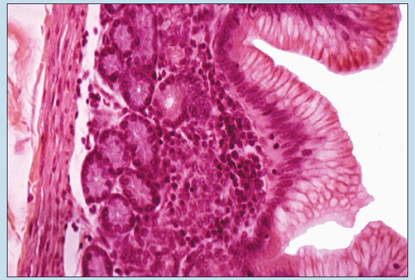 Figure 16-17 is a slide image of pyloric stomach at 100X magnification.