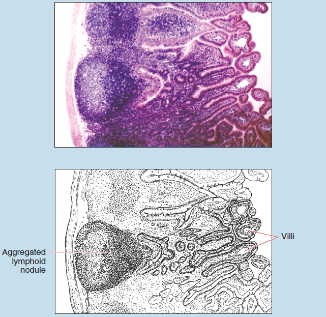 Figure 16-20 is a slide image (upper) and a sketch image (lower) of ileum of the small intestine at 25X magnification. The sketch is labelled to show aggregated lymphoid nodule and villi.