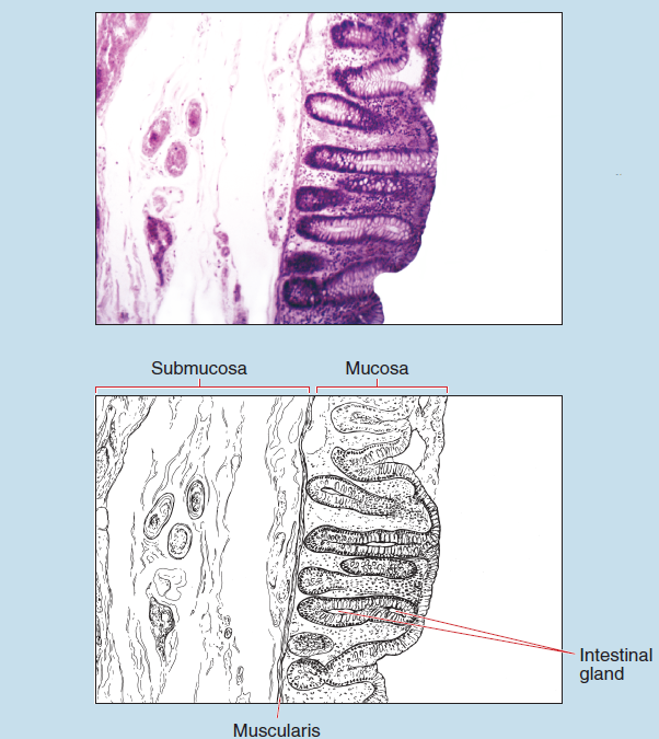 Figure 16-21 is a slide image (upper) and a sketch image (lower) of colon at 25X magnification. The sketch image is labelled to show submucosa, mucosa, intestinal gland, and muscularis mucosae.