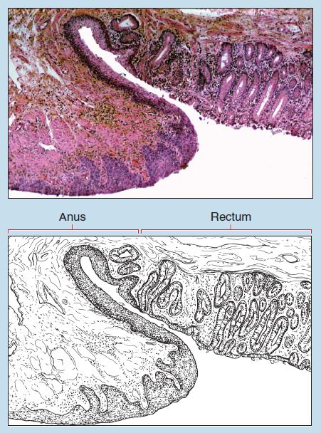 Figure 16-22 is a slide image (upper) and sketch image (lower) of rectal-anal junction at 25X magnification. The sketch is labelled to show anus and rectum.