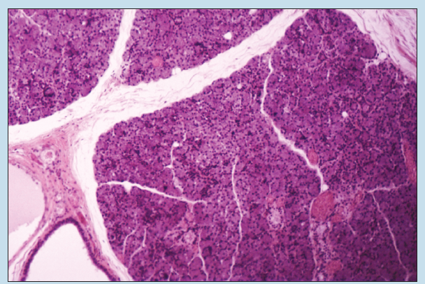 Figure 16-5 is a slide iimage of Parotid salivary gland at 25X magnification.