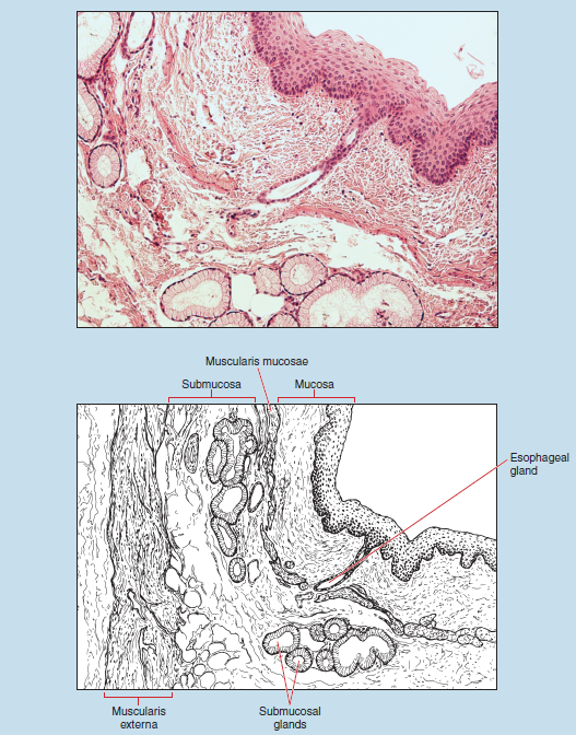 Figure 16-9 is a slide image (upper) and sketch image (lower) of esophagus (upper one third) at 25X magnification. The sketch is labelled to demonstrate submucosa, muscularis mucosae, mucosa, esophageal gland, submucosal glands, and muscularis externa.