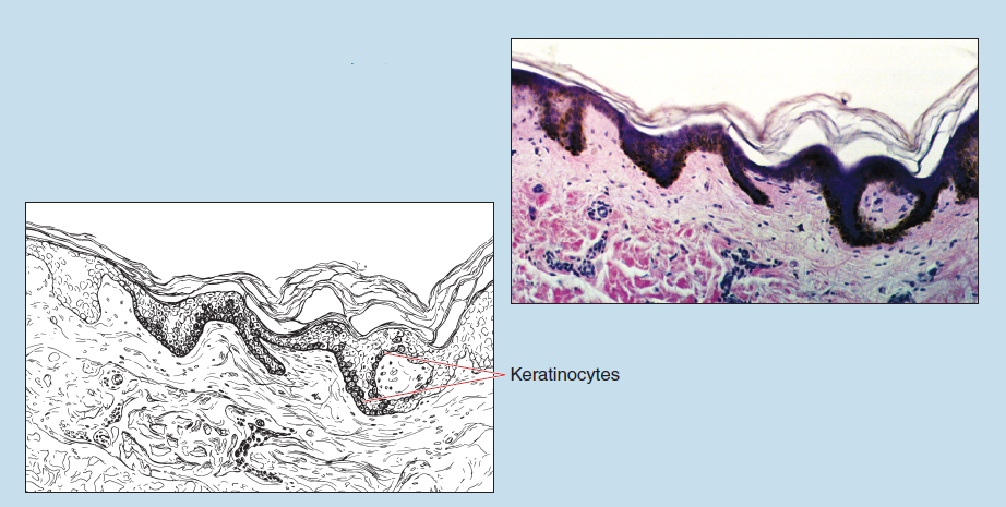 Figure 17-2 is a slide image (upper) and a sketch image (lower) of thin skin (pigmented) at 25X magnification. The sketch is labelled to show keratinocytes.