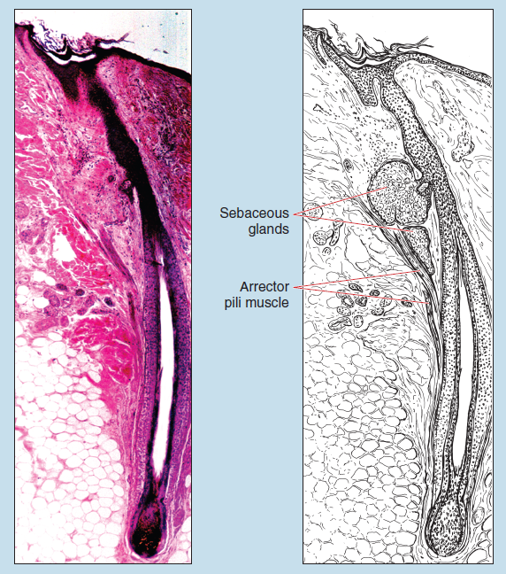 Figure 17-3 is a slide image (left) and a sketch image (right) of scalp demonstrating a hair follicle at 25X magnification. The sketch is labelled to show sebaceous glands and arrector pili muscile.