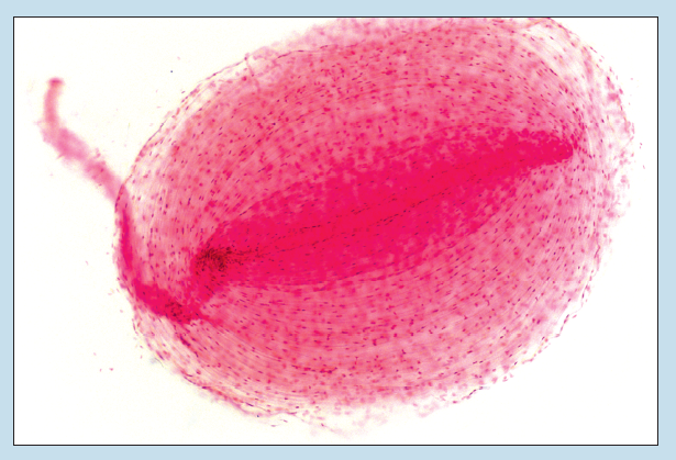 Figure 17-4 is a slide image of lamellar corpuscle at 70X magnification.