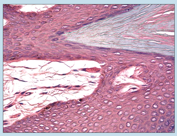Figure 17-5 is a slide image of tactile corpuscle at 70x magnification.