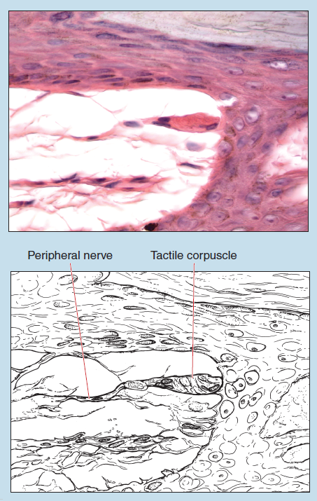 Figure 17-6 is a slide image (upper) and a sketch image (lower) of tactile corpuscle at 140X magnification. The sketch is labelled to illustrate peripheral nerve and tactile corpuscle.