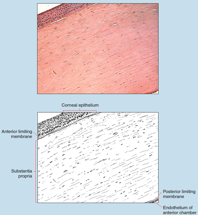 Figure 18-3 contains a slide image (upper) and sketch image (lower) of the same section of cornea at 35X magnification. The sketch is labelled to illustrate the corneal epithelium, post limiting membrane, endothelium of anterior chamber, anterior limiting membrane, and substantia propria.