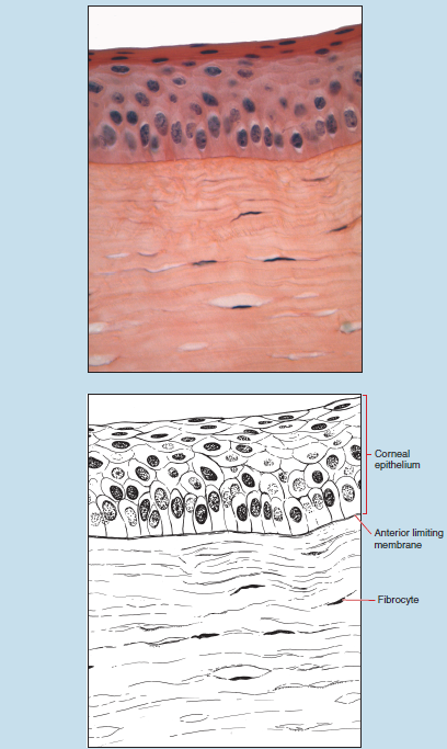 Figure 18-4 is a slide image (upper) and a sketch image (lower) of the same piece of cornea at 40X magnification. The sketch is notated to illustrate the corneal epithelium, anterior limiting membrane, and a fibrocyte.