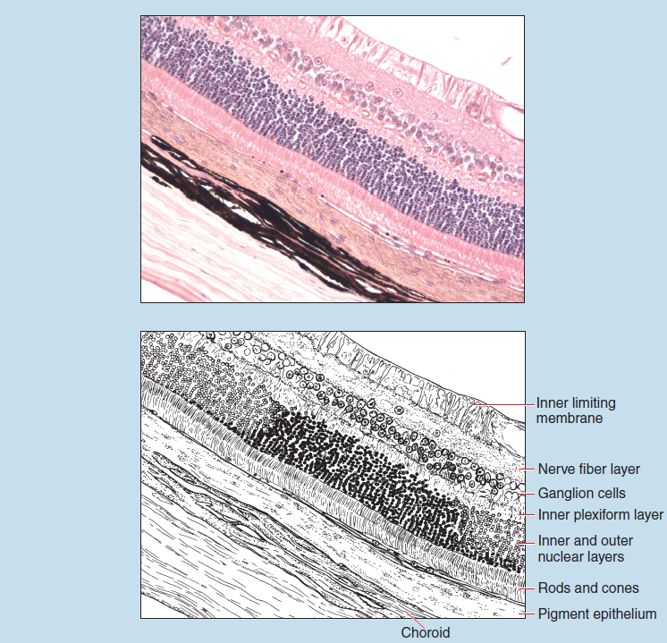 Figure 18-6 contains a slide image (upper) and a sketch image (lower) of a section of retina at 70X magnification. The sketch is labelled to illustrate the inner limiting membrane, nerve fiber layer, ganglion cells, inner plexiform layer, inner and outer nuclear layers, rods and cones, pigment epithlelium, and a choroid.
