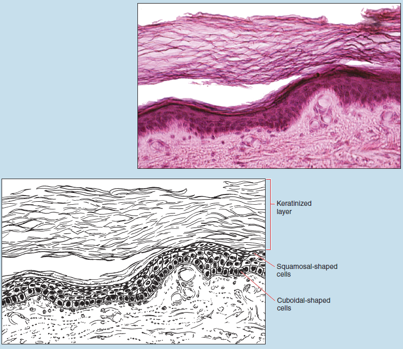 Two images of stratified squamous epithelium (thin skin/Caucasian at 100X magnification. The upper image is a microscope slide image. The lower image is a sketched image of the same tissue. The sketch is labelled to show the keratinized layer, squamosal-shaped cells, and cuboidal-shaped cells.