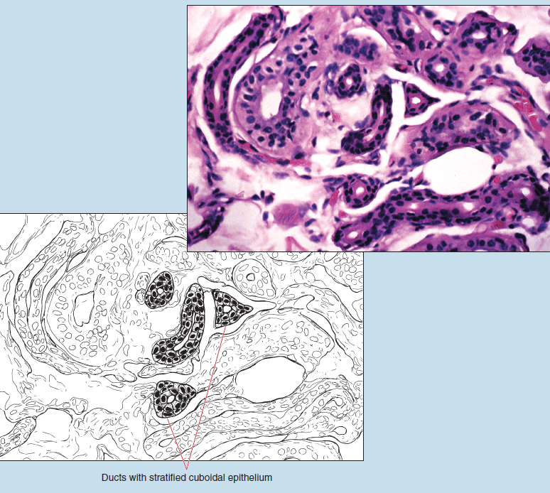 Two images of stratified cuboidal epithelium (sweat gland duct). The upper image is a microscope slide image, while the lower is a sketched image of the same tissue. The sketched image (lower) is labelled to show the ducts with stratified cuboidal epithelium.